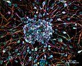 Rat primary cortical neuron culture, deconvolved z-stack overlay; featured picture